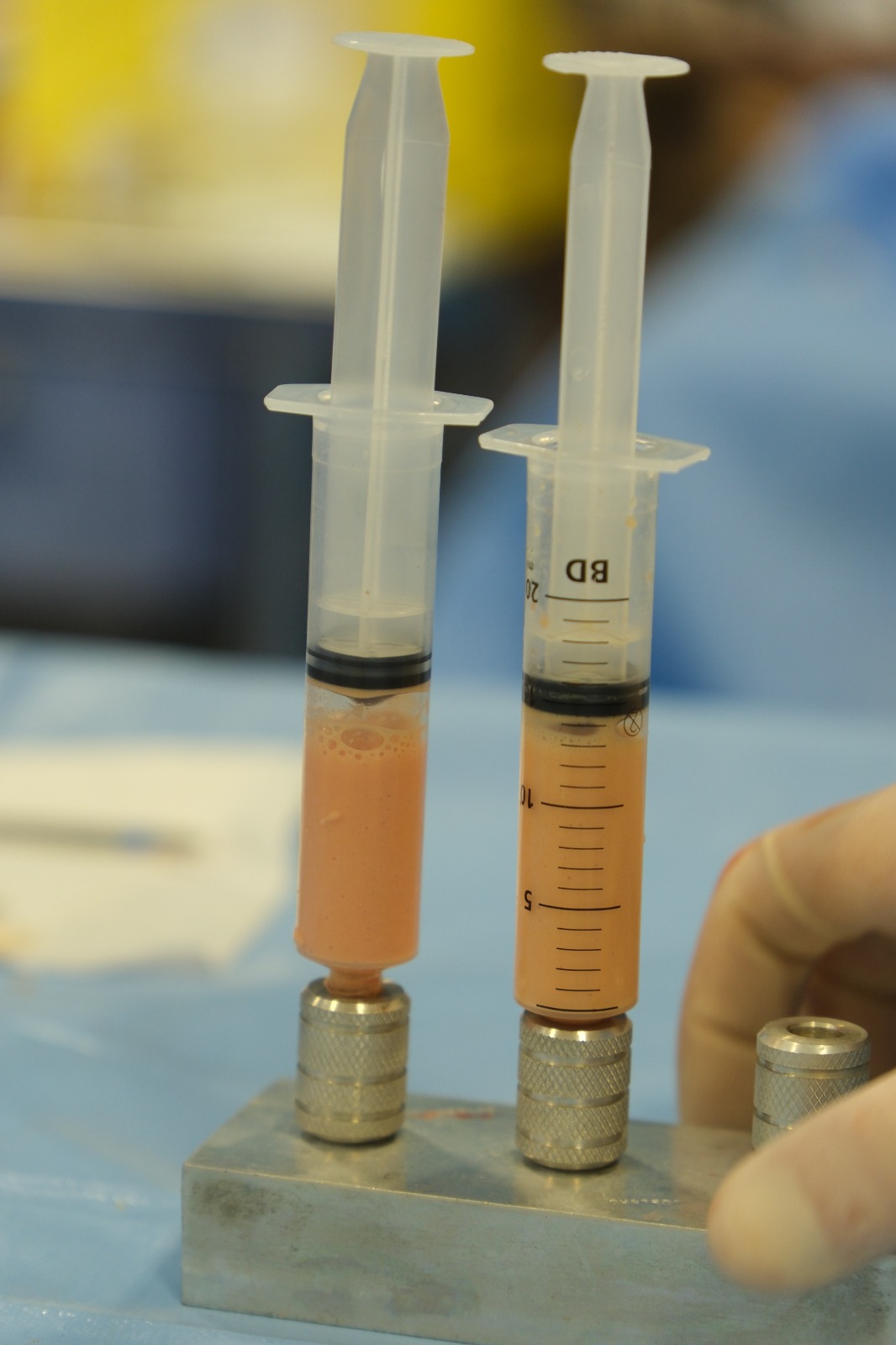 PRP — Plasma Rico em Plaquetas
