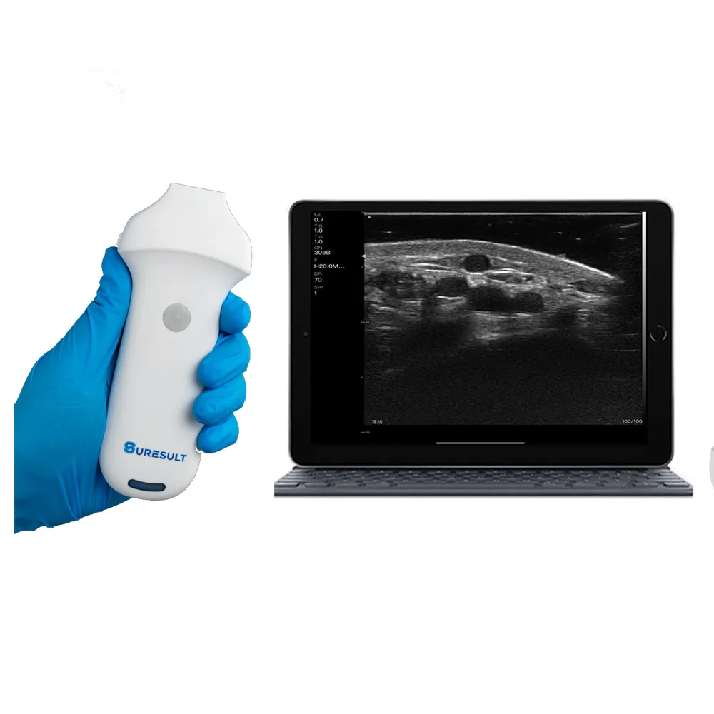 Ultrassom musculoesquelético